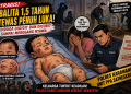Balita 1,5 Tahun Tewas Penuh Luka! Diduga Digigit dan Dicubit Sampai Meregang Nyawa